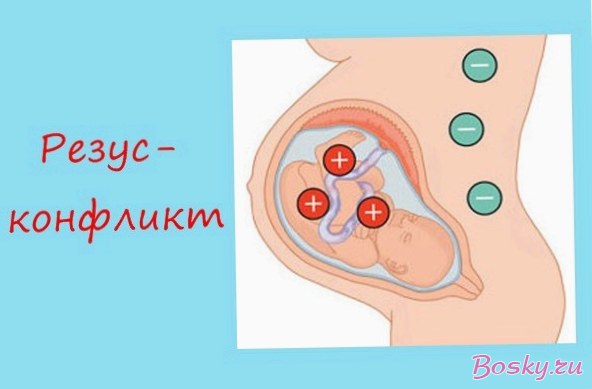 Замершая беременность: обстоятельства страшной патологии